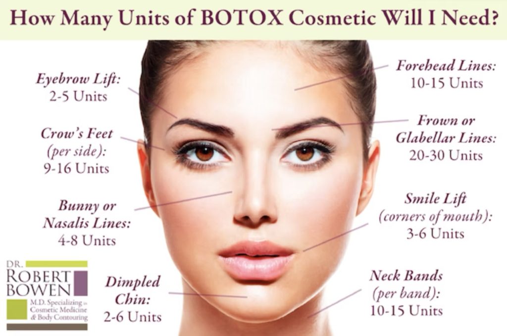 How much Botox will I need graphic