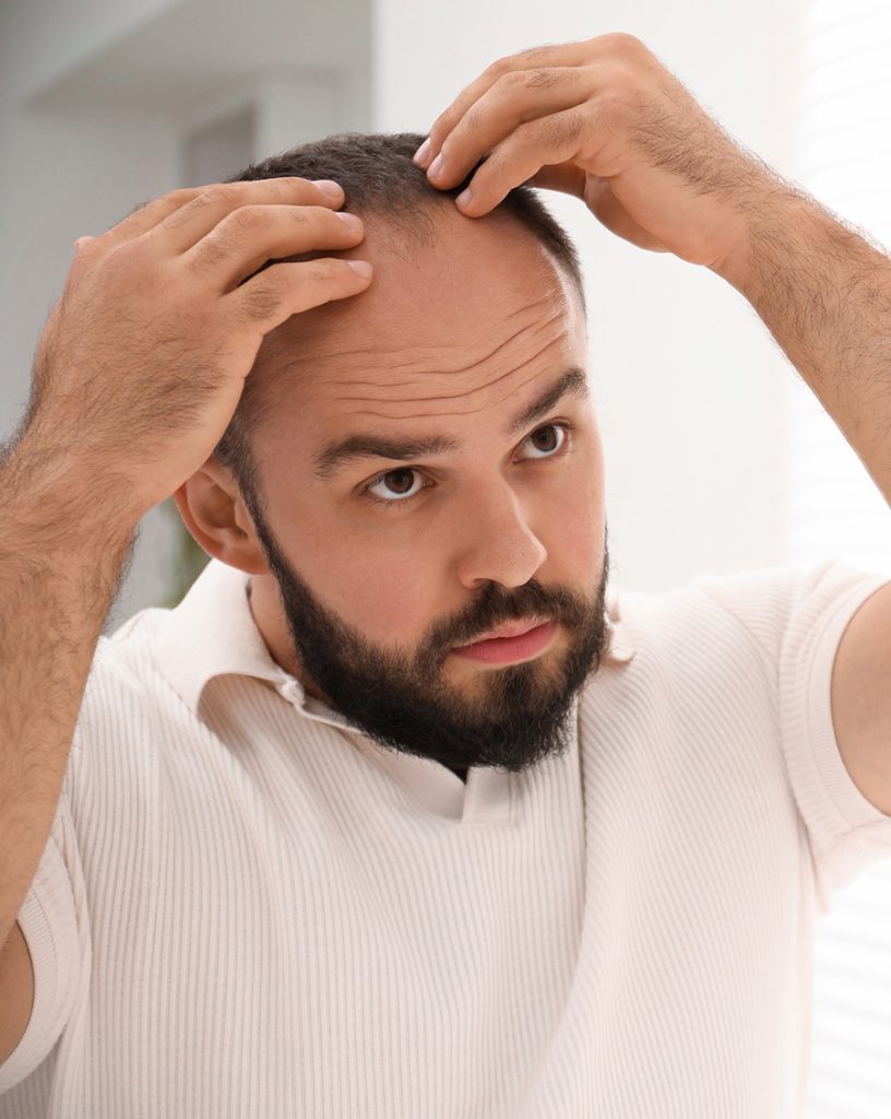 man checking his hair loss